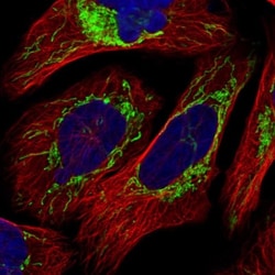 TUFM Antibody, Novus Biologicals:Antibodies:Primary Antibodies